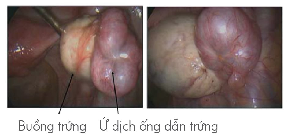 7. Các phương pháp thay thế và điều trị không phẫu thuật